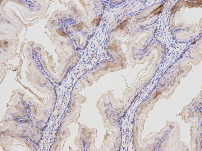 MAL Antibody in Immunohistochemistry (Paraffin) (IHC (P))