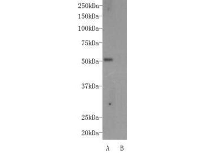 AIRE Antibody in Western Blot (WB)