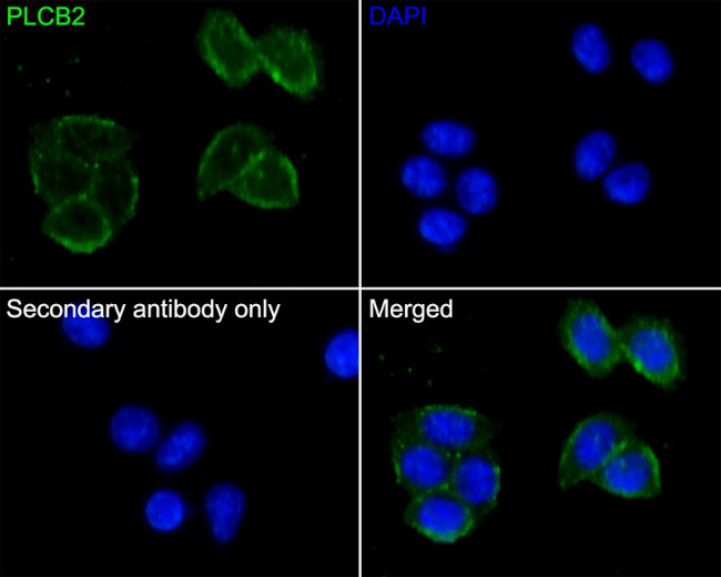 PLCB2 Antibody in Immunocytochemistry (ICC/IF)