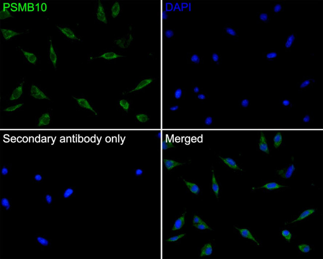 PSMB10 Antibody in Immunocytochemistry (ICC/IF)