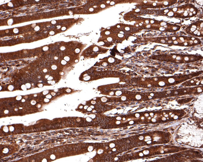 PLCB3 Antibody in Immunohistochemistry (Paraffin) (IHC (P))