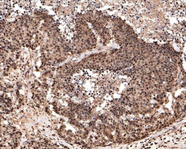 PGBD5 Antibody in Immunohistochemistry (Paraffin) (IHC (P))