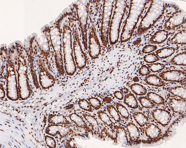 Histone H2B Antibody in Immunohistochemistry (Paraffin) (IHC (P))