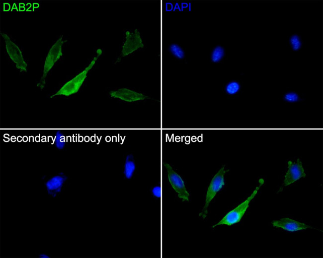 DAB2IP Antibody in Immunocytochemistry (ICC/IF)