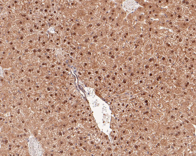 PSME4 Antibody in Immunohistochemistry (Paraffin) (IHC (P))