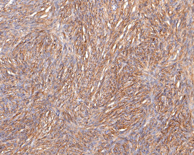 Podoplanin Antibody in Immunohistochemistry (Paraffin) (IHC (P))