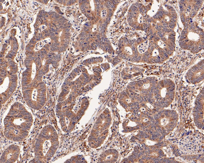 USP8 Antibody in Immunohistochemistry (Paraffin) (IHC (P))