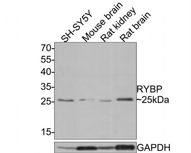 RYBP Antibody in Western Blot (WB)