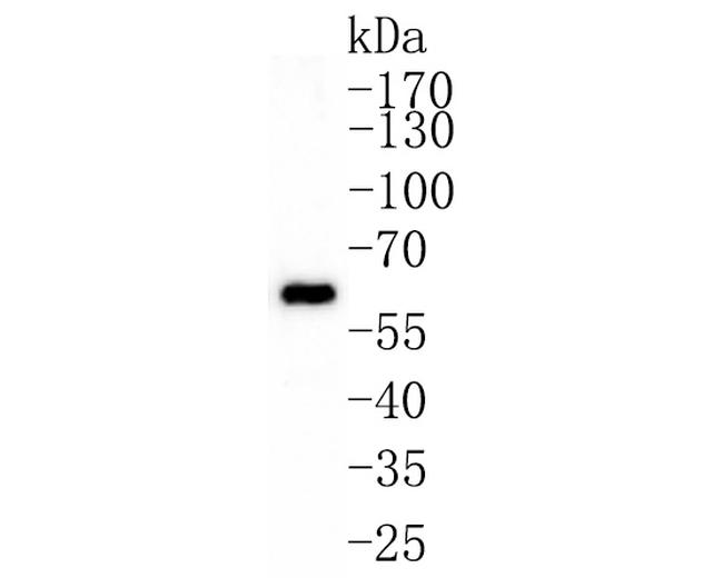 GRB7 Antibody in Western Blot (WB)
