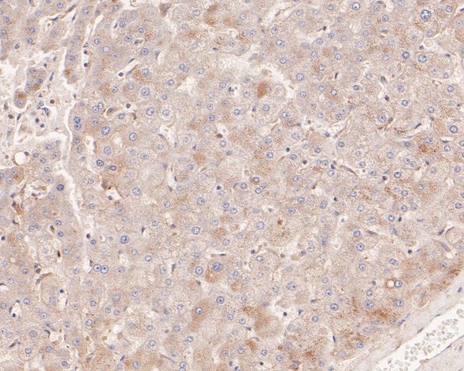 beta-1,2 Adaptin Antibody in Immunohistochemistry (Paraffin) (IHC (P))