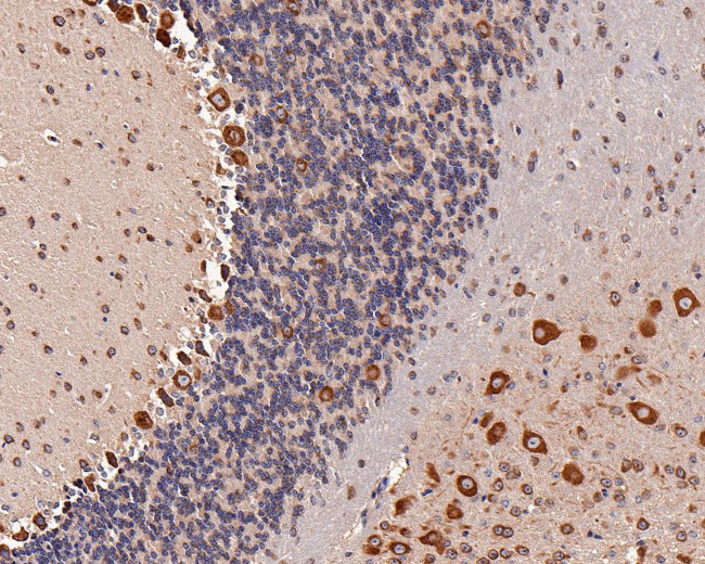 EEF1G Antibody in Immunohistochemistry (Paraffin) (IHC (P))