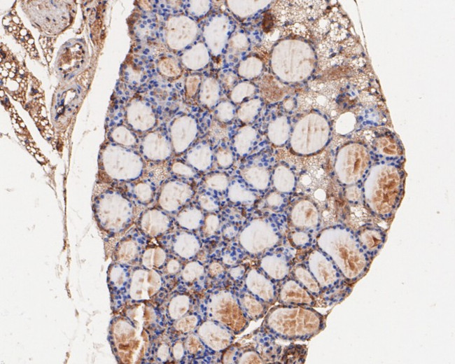 RhoGDI Antibody in Immunohistochemistry (Paraffin) (IHC (P))