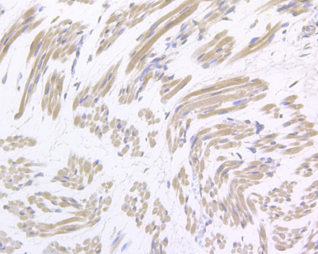 Gemin 2 Antibody in Immunohistochemistry (Paraffin) (IHC (P))