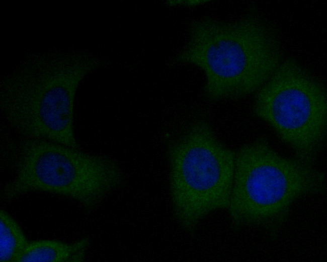 CD8 alpha Antibody in Immunocytochemistry (ICC/IF)