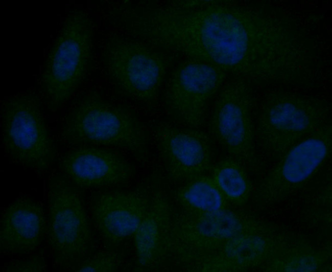 IP3 Receptor 2 Antibody in Immunocytochemistry (ICC/IF)