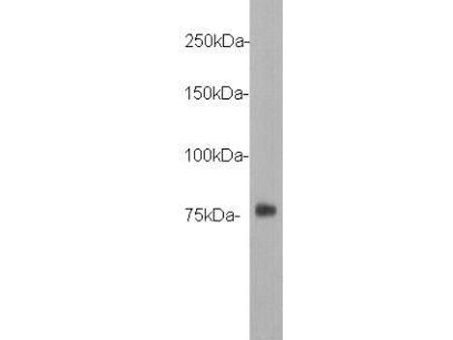 DYKDDDDK Tag Antibody in Western Blot (WB)