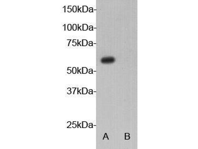 AIRE Antibody in Western Blot (WB)