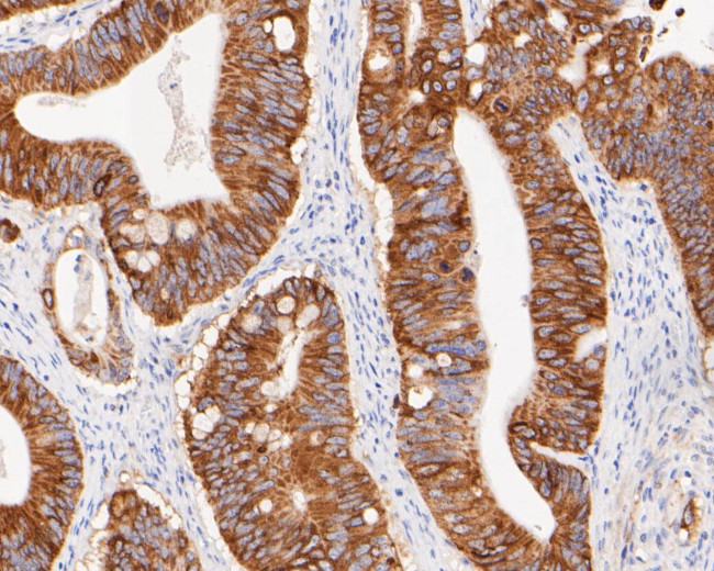 FAT1 Antibody in Immunohistochemistry (Paraffin) (IHC (P))