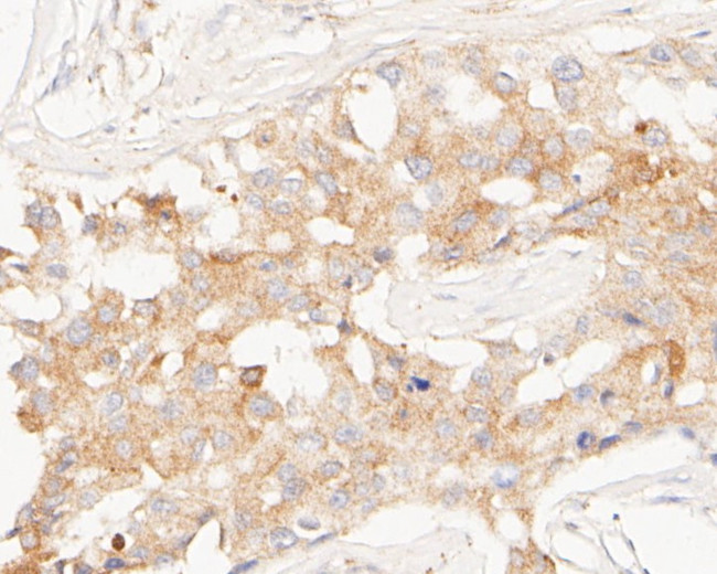 TMEM67 Antibody in Immunohistochemistry (Paraffin) (IHC (P))