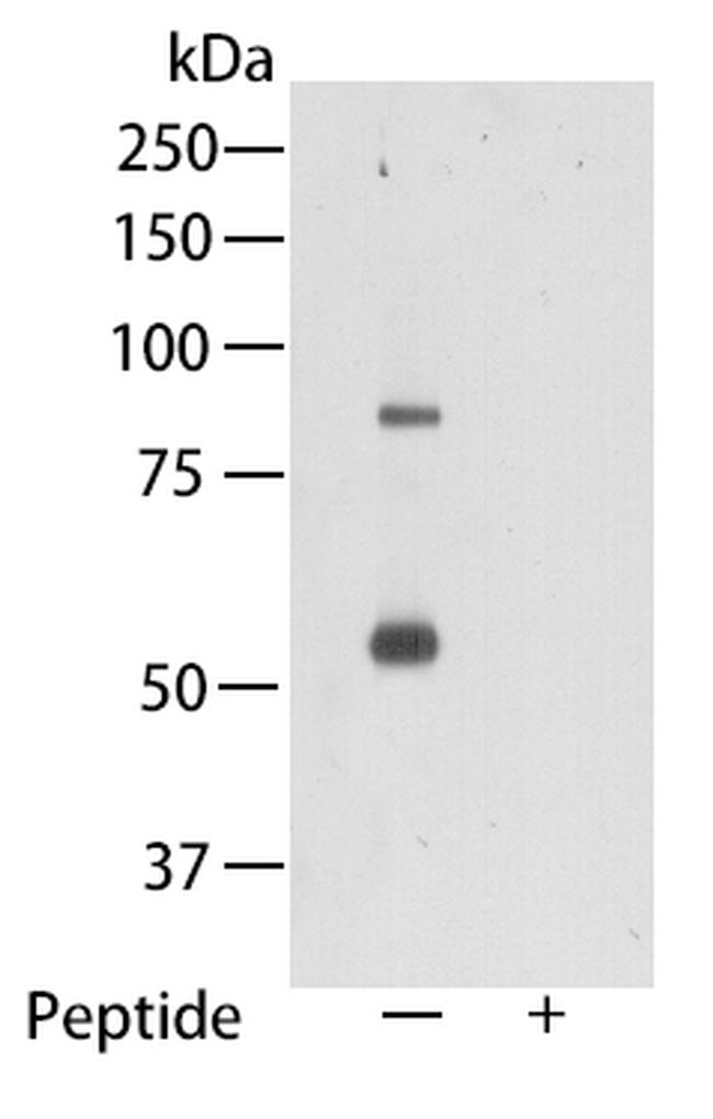 TMEM2 Antibody in Western Blot (WB)