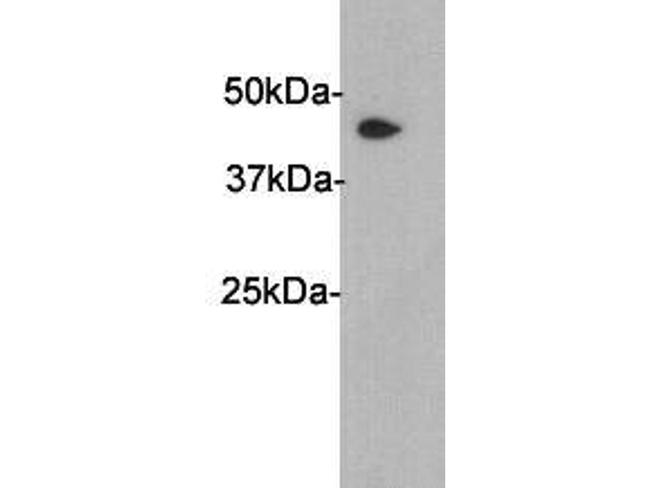 SERPINA5 Antibody in Western Blot (WB)