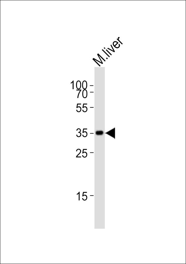 HMX2 Antibody in Western Blot (WB)