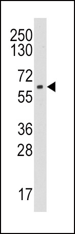 Aromatase Antibody in Western Blot (WB)