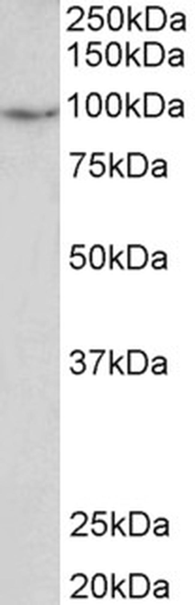 PDE4B Antibody in Western Blot (WB)
