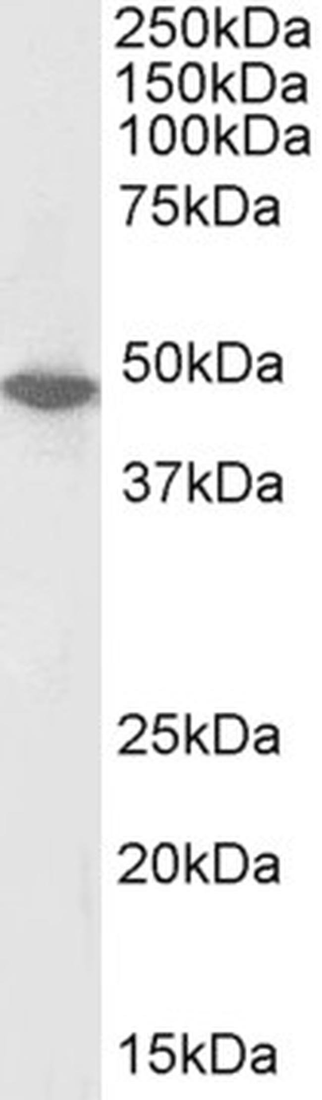 ORC4 Antibody in Western Blot (WB)
