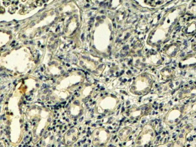 Tensin 1 Antibody in Immunohistochemistry (Paraffin) (IHC (P))