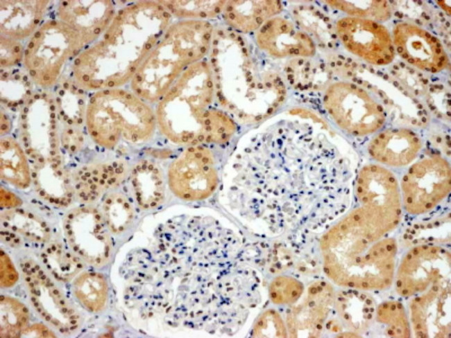 WHIP Antibody in Immunohistochemistry (Paraffin) (IHC (P))