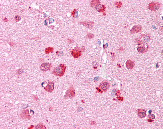 CHN2 Antibody in Immunohistochemistry (Paraffin) (IHC (P))