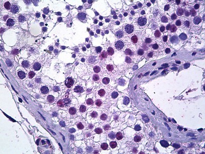 TSPYL2 Antibody in Immunohistochemistry (Paraffin) (IHC (P))