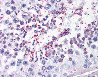 DUSP14 Antibody in Immunohistochemistry (Paraffin) (IHC (P))