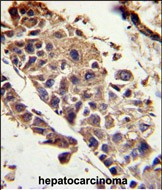 PEDF Antibody in Immunohistochemistry (Paraffin) (IHC (P))
