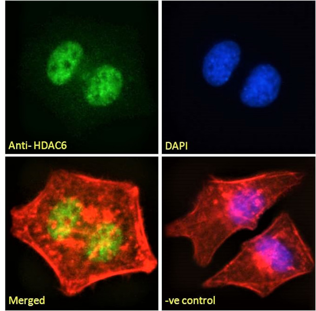 HDAC6 Antibody in Immunocytochemistry (ICC/IF)