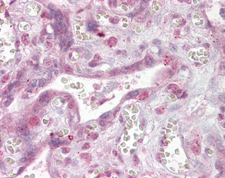 NFATC4 Antibody in Immunohistochemistry (Paraffin) (IHC (P))