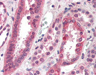 CENPF Antibody in Immunohistochemistry (Paraffin) (IHC (P))