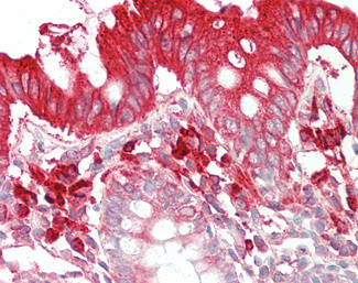 TFB2M Antibody in Immunohistochemistry (Paraffin) (IHC (P))