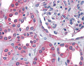 AS3MT Antibody in Immunohistochemistry (Paraffin) (IHC (P))