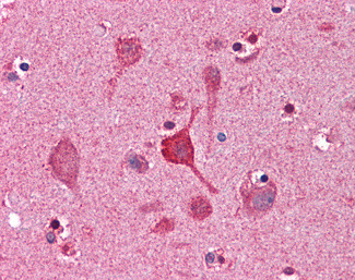 CCNDBP1 Antibody in Immunohistochemistry (Paraffin) (IHC (P))