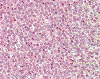 KMT2D Antibody in Immunohistochemistry (Paraffin) (IHC (P))