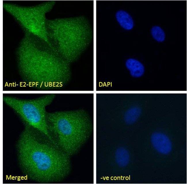 UBE2S Antibody in Immunocytochemistry (ICC/IF)