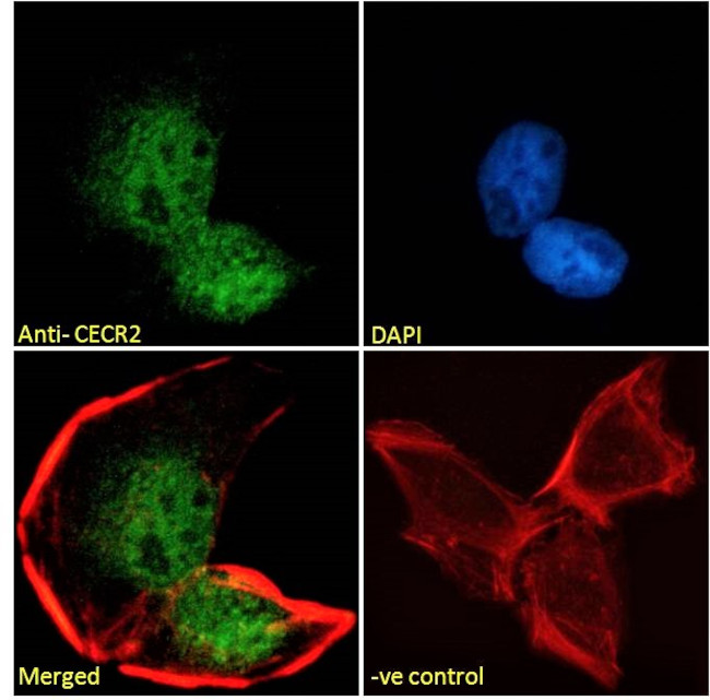 CECR2 Antibody in Immunocytochemistry (ICC/IF)