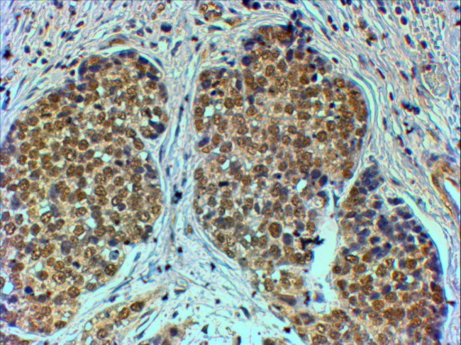 TRIM24 Antibody in Immunohistochemistry (Paraffin) (IHC (P))