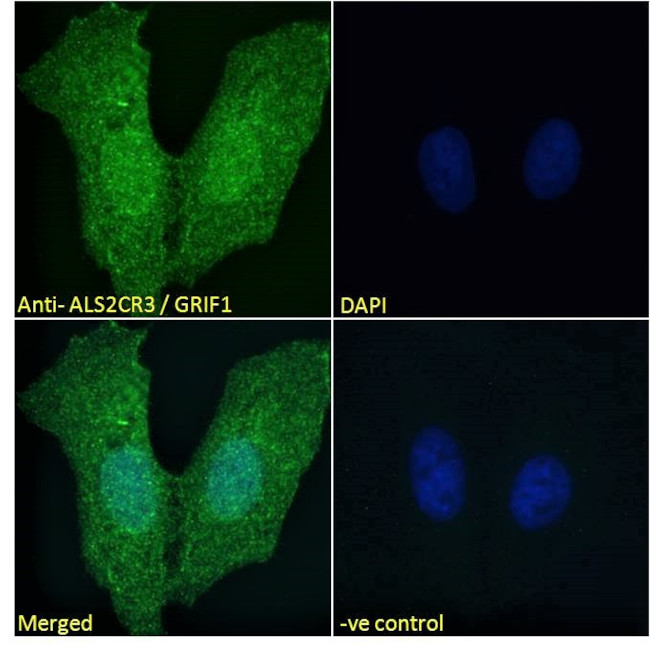 TRAK2 Antibody in Immunocytochemistry (ICC/IF)