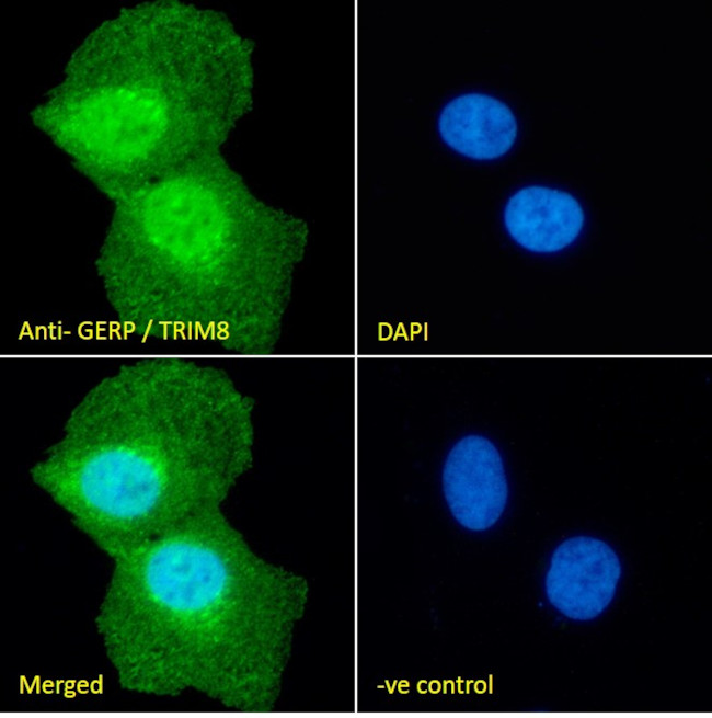 TRIM8 Antibody in Immunocytochemistry (ICC/IF)