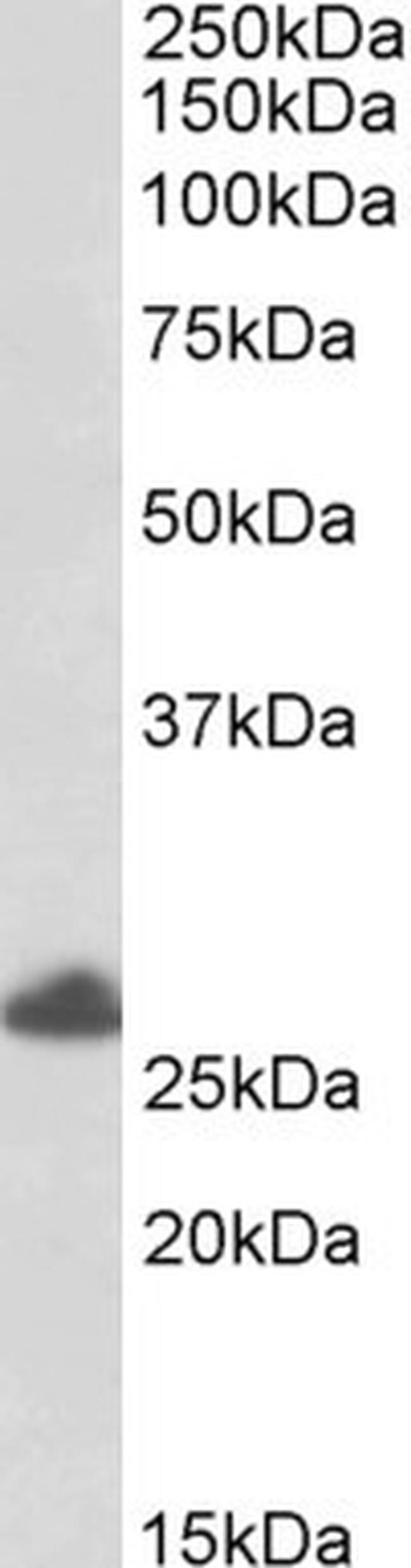 TRIM40 Antibody in Western Blot (WB)