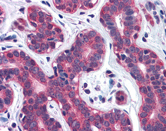 SNX12 Antibody in Immunohistochemistry (Paraffin) (IHC (P))