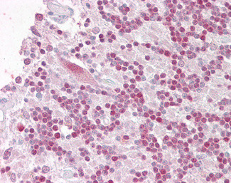 RNF36 Antibody in Immunohistochemistry (Paraffin) (IHC (P))